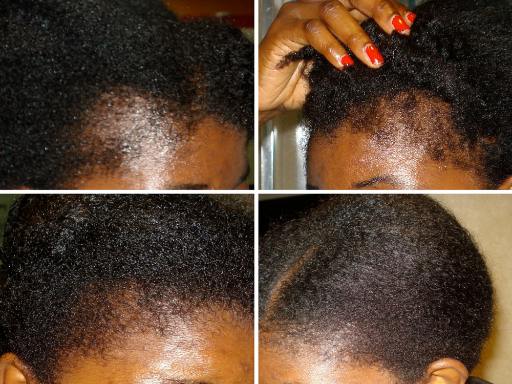 Riche Roots Hair Oil